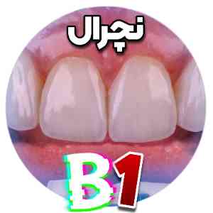 کامپوزیت لیرینگ B1 شید نچرال