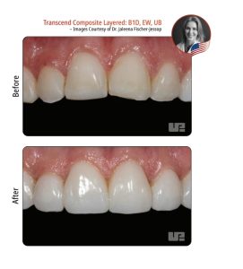 کامپوزیت نچرال شید B1