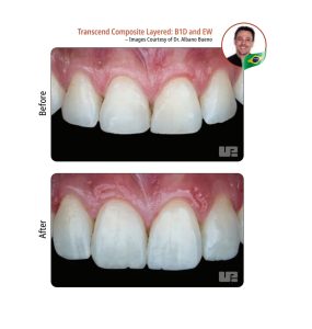 کامپوزیت لیرینگ مروارید نچرال