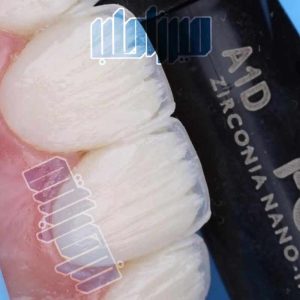 کیت مواد دندانپزشکی کامپوزیت لیرینگ رنگ A1 در فروشگاه مواد دندانپزشکی میرزاطب